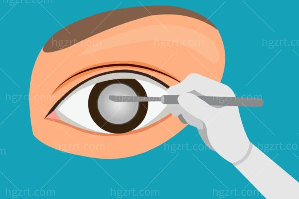 60岁/70岁/80岁老年人做白内障手术免费吗