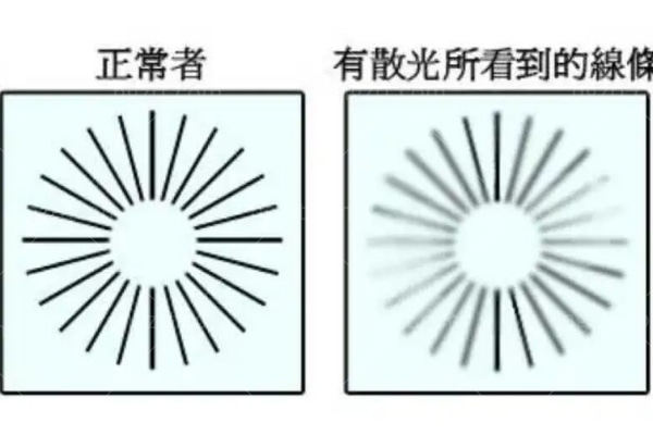 高度散光加近视能做飞秒激光手术吗