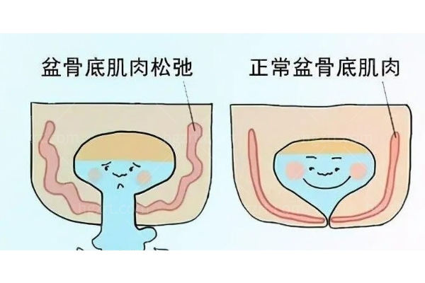 女性紧缩手术多少费用