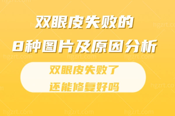 双眼皮失败的8种图片及原因分析,双眼皮失败了还能修复好吗