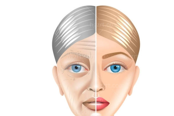 钻石超塑多少钱一次