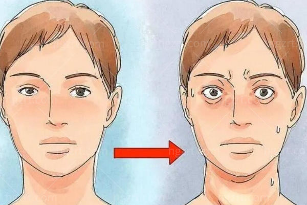 甲亢突眼矫正手术多少钱