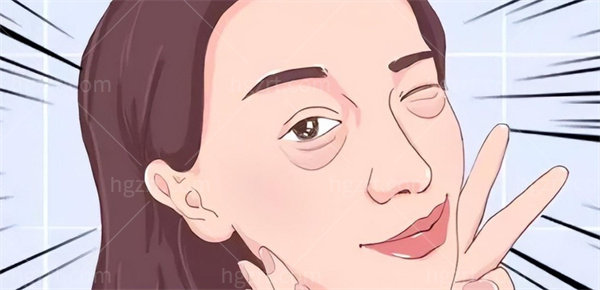 上海筋膜提升哪家做得好