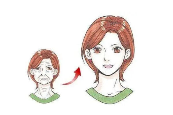 v美减龄面部提升反应好不好能维持几年 高呼绝绝子的面部提升术