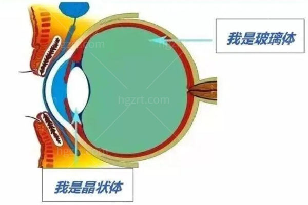 眼睛玻璃体容易发生哪些病变