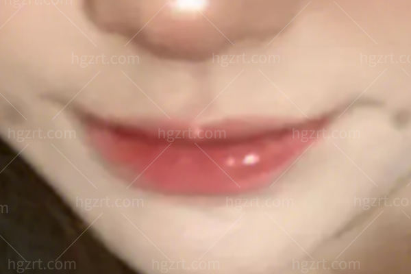 做梨涡手术的医院有哪些？想要拥有妩媚动人笑容全靠这几家！