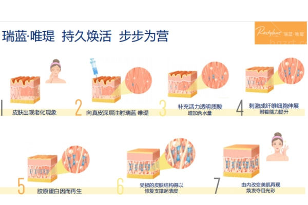 瑞蓝唯瑅是玻尿酸还是补水针?水光中的爱马仕有多神奇？