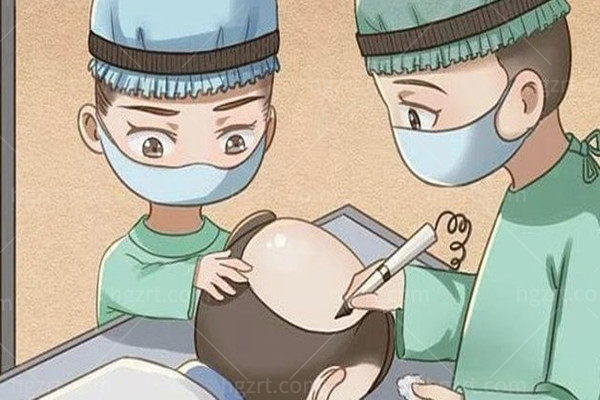 韩国植发有名的医院