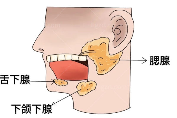 唾液腺囊肿激光手术多少钱？和微波手术的区别是什么？