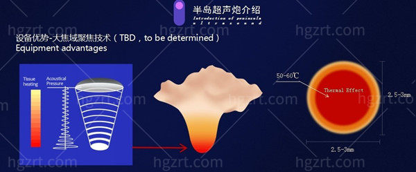 超声炮适合多大年龄