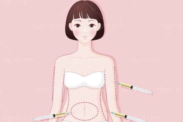 揭晓贵阳吸脂哪家医院好?排名靠前价格便宜的看这里就OK了