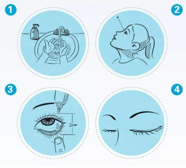 硫酸阿托品滴眼液能治近视吗