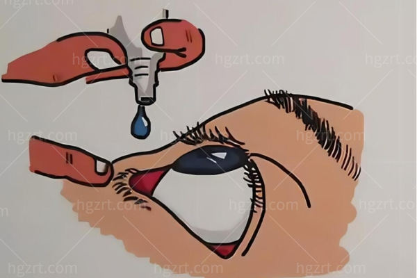 阿托品0.01%控制近视是真的吗？来看家长眼中的近视神药阿托品到底怎么样