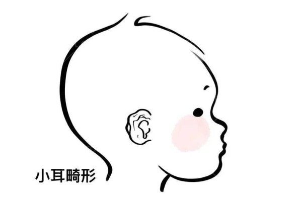 有没有知道郑州市第二中医院医生团队名单？想带孩子做耳再造。