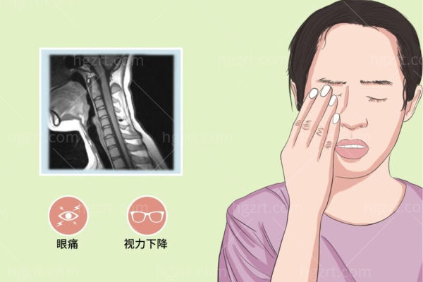 眼神经发炎是怎么回事？眼睛出现这四种症状一定要警惕