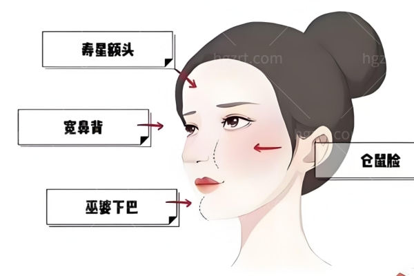 公主小脸馒化针可以打吗?可以打修复减薄技术不错价格不贵