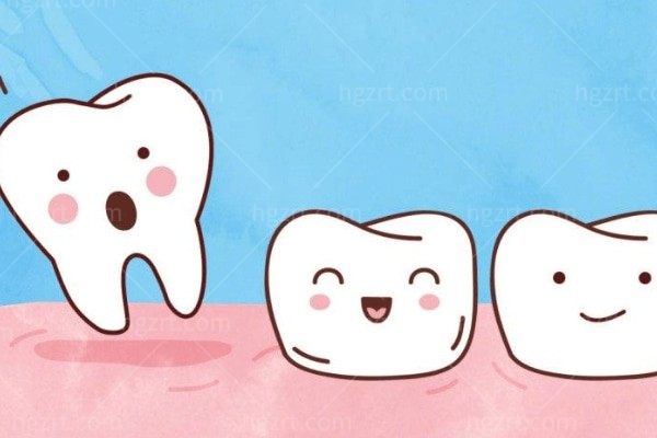 2024香港牙科诊所收费标准 曝光种牙/拔牙/洗牙/矫牙以及靠谱的牙科医院