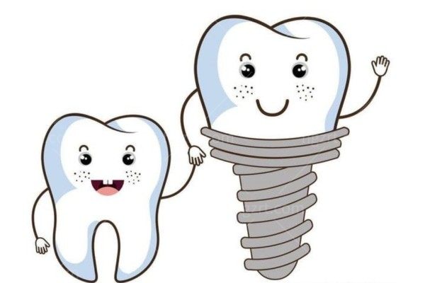 种植牙一期二期三期流程及时间 30分钟植入/装基台/装牙冠解决牙口缺失问题