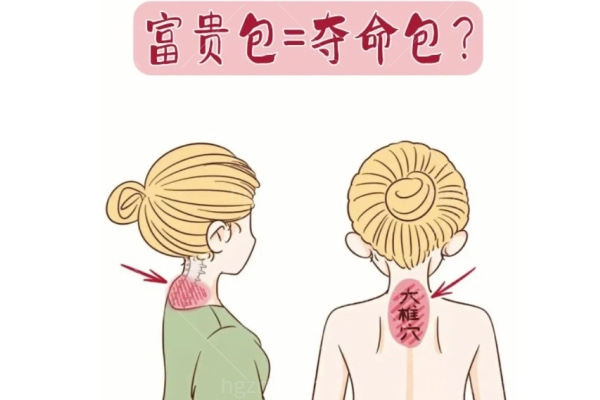 富贵包吸脂手术多少钱