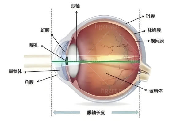眼角膜移植的经历和感受 病变角膜变健康重回1.0视力太香了