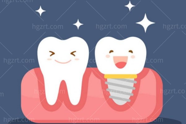 2024牙科价目收费表：洗牙/补牙/拔牙/种植牙/牙齿矫正费用不同
