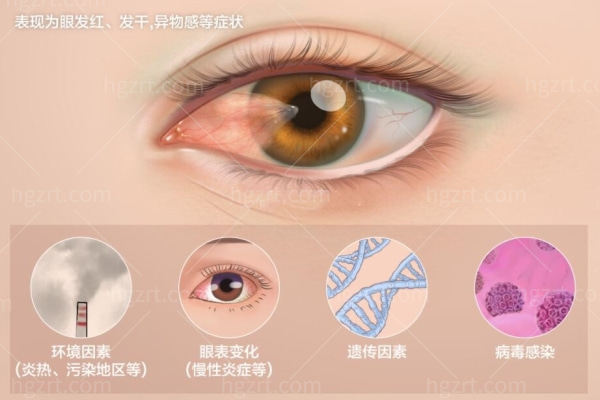 18种常见眼科疾病分享：对自己的眼睛好一点别让自己后悔