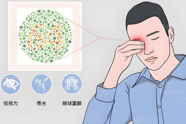 眼睛色盲是什么原因引起的怎么治疗？原来色盲眼中是这样的