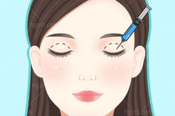 武汉王海平双眼皮修复价格泄露，从技术和口碑评价来看很值