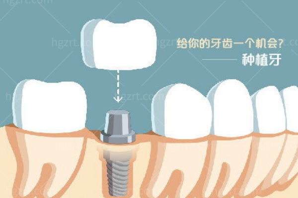 北**腔大型医院排名前十 **/**/和谐/积水潭这几家技术高优势强可