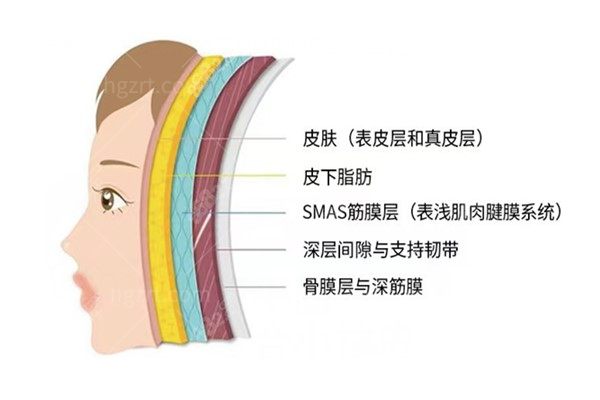 面部提升
