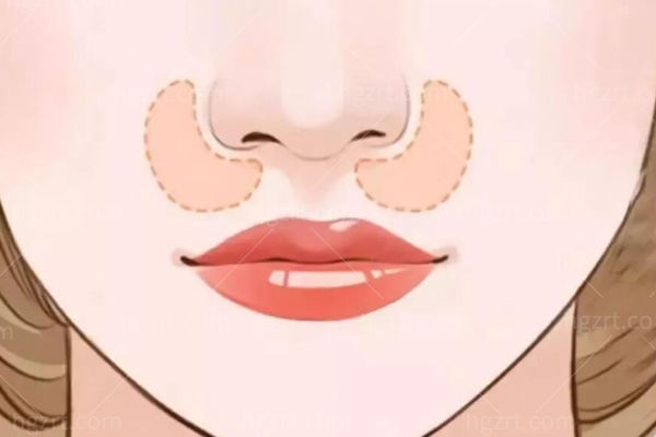 2025深圳做鼻部修复好的整形医院