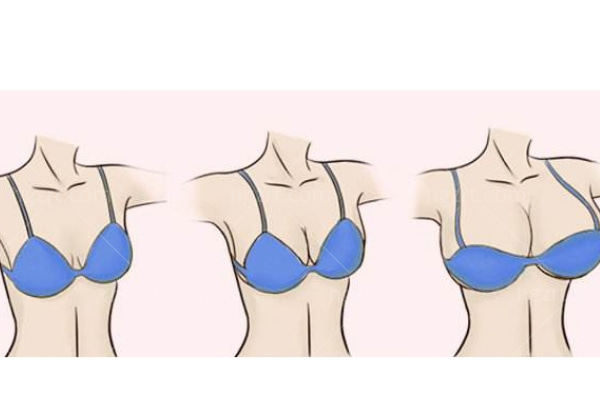 上海唐毅隆胸怎么样