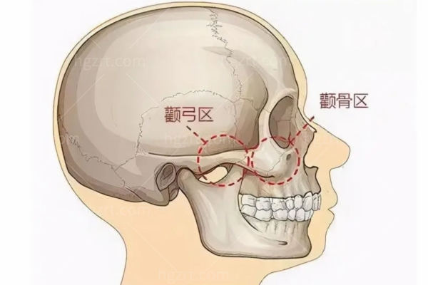 2024上海做下颌角的医院排名哪家好