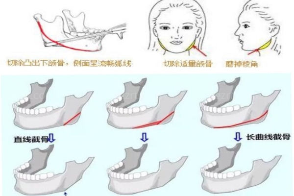 金系美女的脸型特点你知道吗