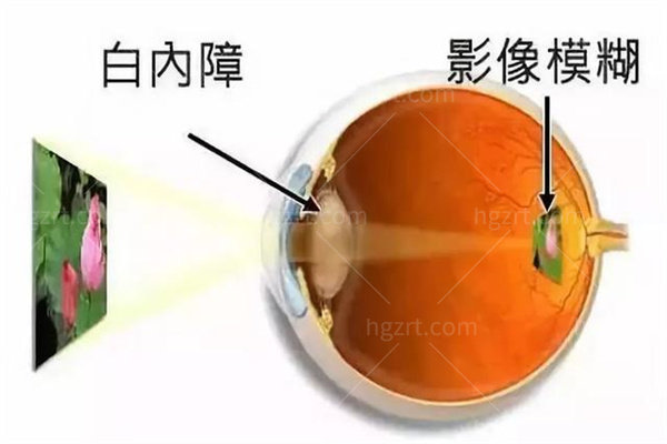 深圳新安希玛林顺潮眼科介绍