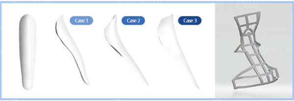 3D定制假体鼻整形术