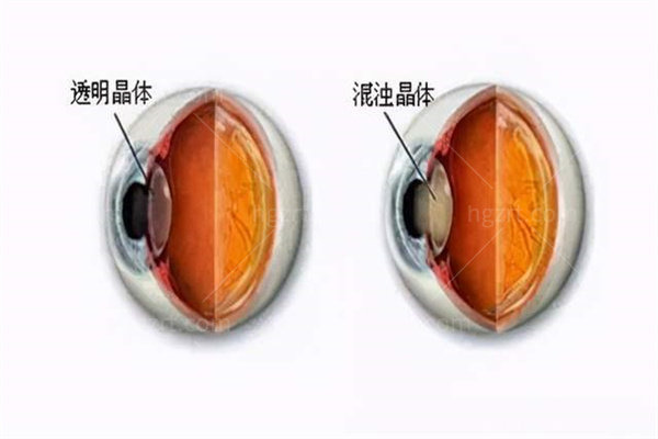 北京美和眼科地址及营业时间