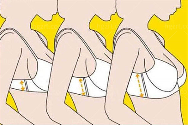 南京美莱整形医院隆胸