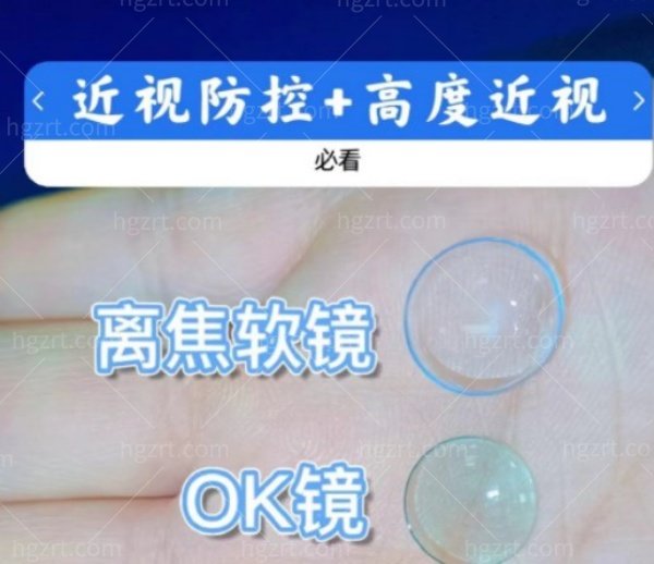 离焦软镜和ok镜哪个贵