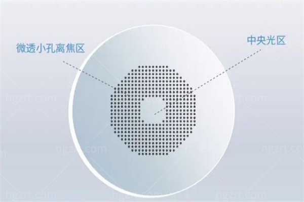 离焦软镜和ok镜的区别