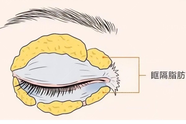 上海双眼皮修复牛的医生有哪些