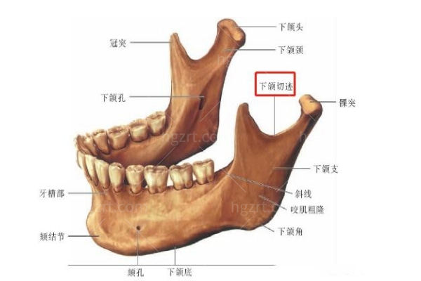 颧骨整形手术需要多少钱