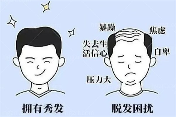 植发医院的中胚治疗多少钱一次？中胚层疗法治疗脱发是智商税吗