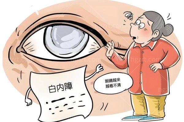 白内障手术免费政策2024最新 一览报名条件/申请流程为60岁以上白内障患者送光明