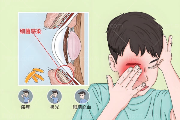 葡萄膜炎是什么原因引起的?葡萄膜和葡萄有啥关系?症状有哪些?