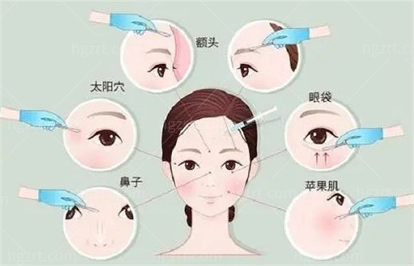 生长因子取出后遗症