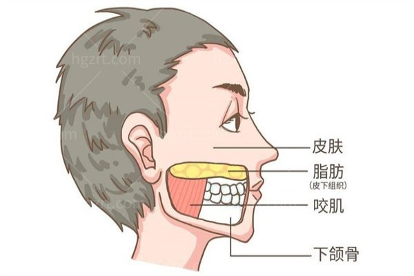 光纤溶脂瘦脸有什么副作用和风险