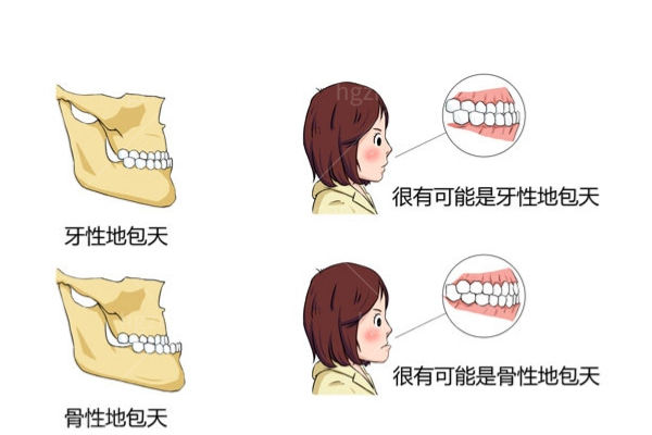 何锦泉偏颌手术价格表 坐诊广大正颌手术技术口碑好40000+