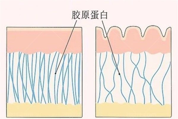 ack胶原蛋白是正规的吗？