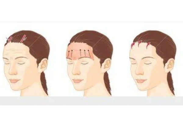 整容医疗机械有哪些医疗美容设备包括哪些？祛斑／吸脂／溶脂／紧致肌肤少不了这几款火爆仪器_https://www.jmylbn.com_新闻资讯_第1张